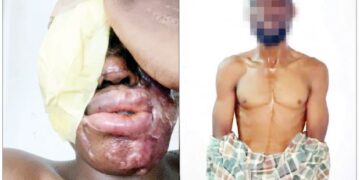 I Was Paid N500,000 to Carry Out Acid Attack on Spa Worker — Suspect