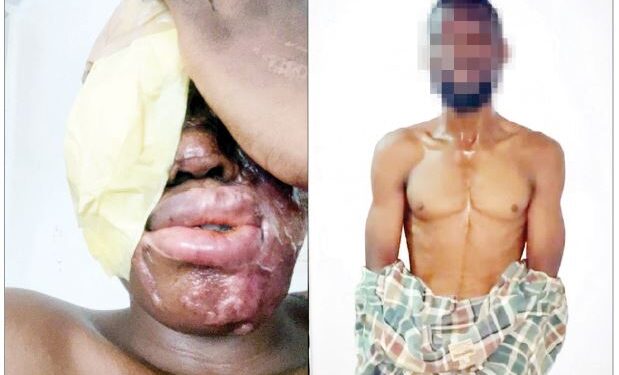 I Was Paid N500,000 to Carry Out Acid Attack on Spa Worker — Suspect