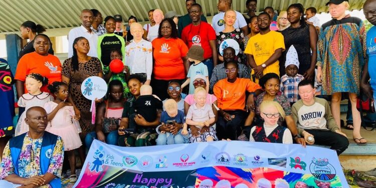 HMGSF, Kids and Teens dazzle as Benue children with Albinism celebrate children day
